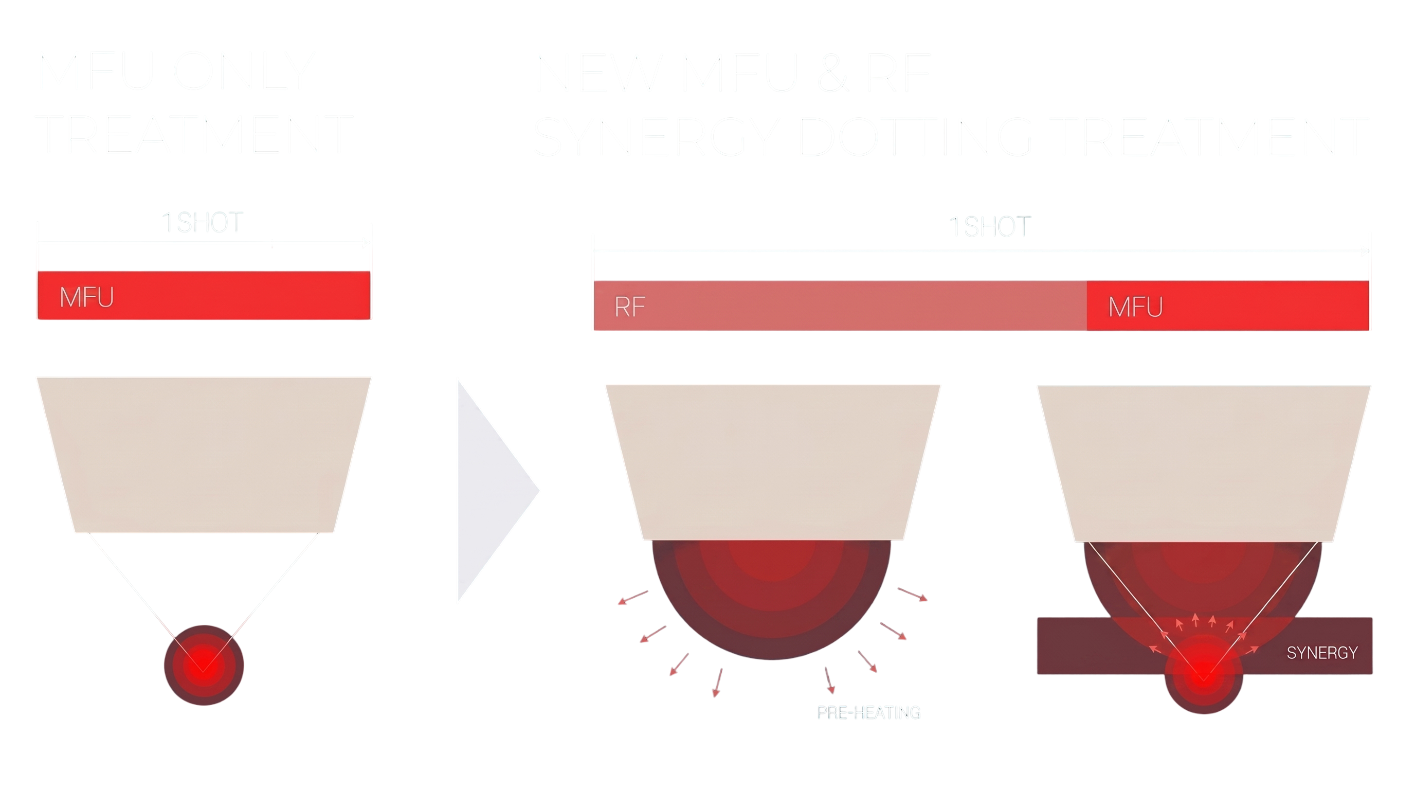 Comparativo de resultados Synergy Dotting MFU + RF em 14 parâmetros